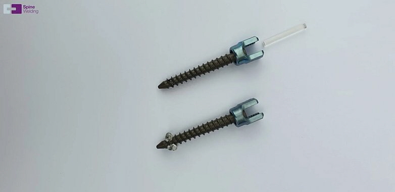 Samaplast - SpineWelding Elaris Pedicle Screw Samaplast - SpineWelding Elaris Pedicle Screw